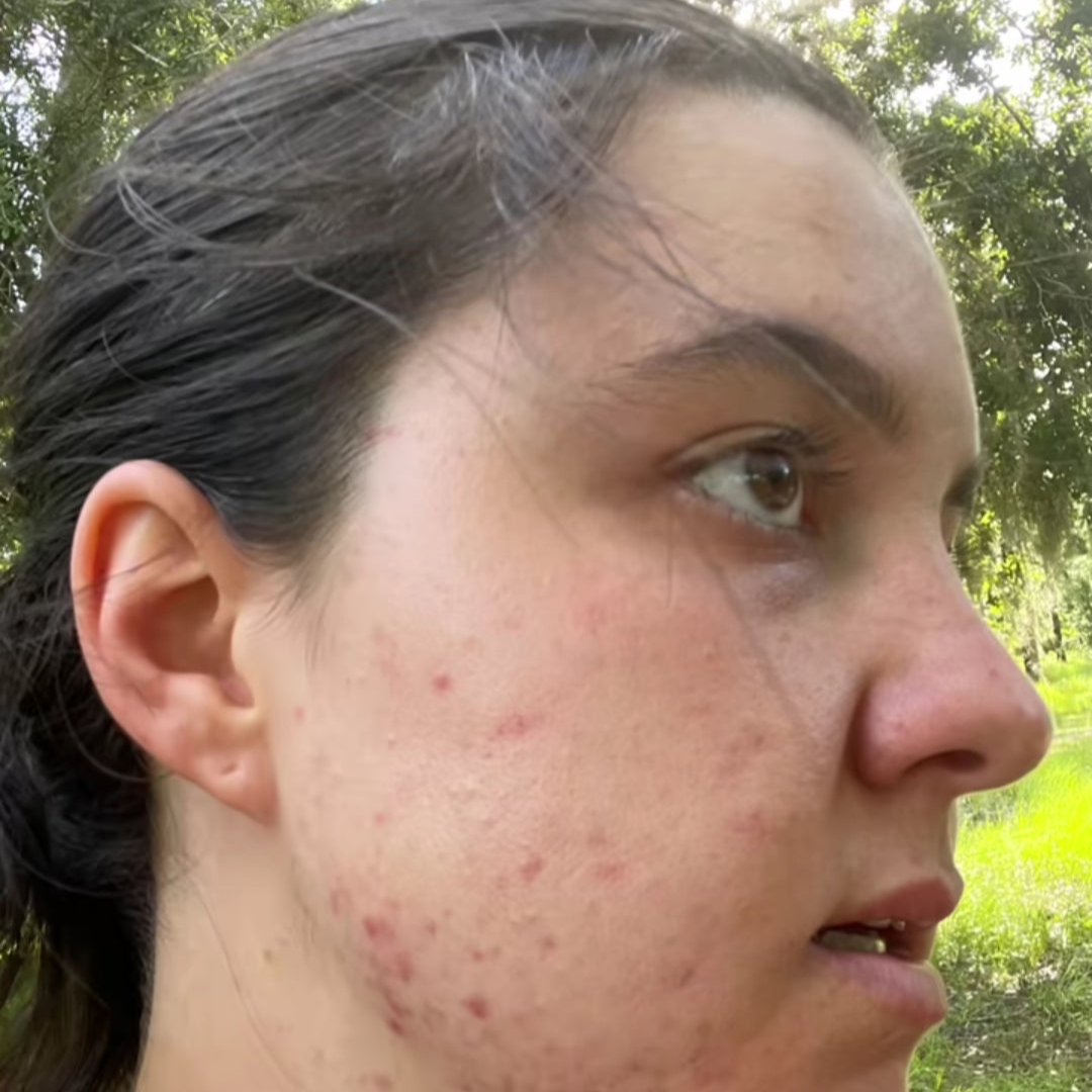image comparison before